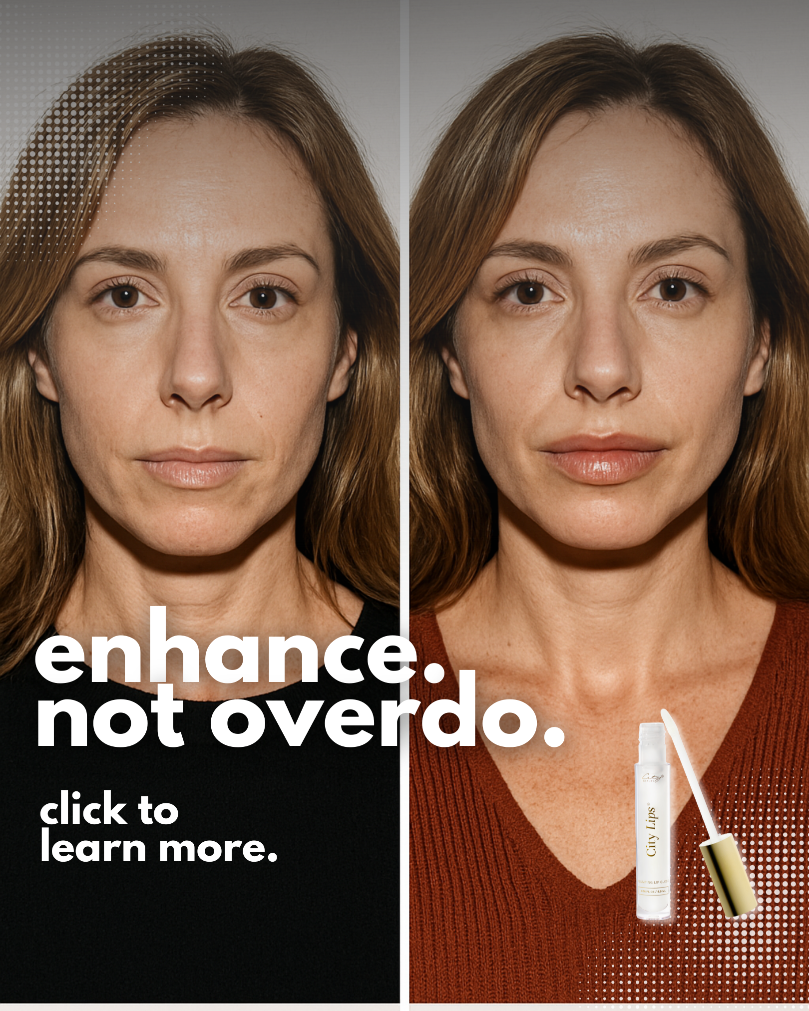 City Lips before and after ad